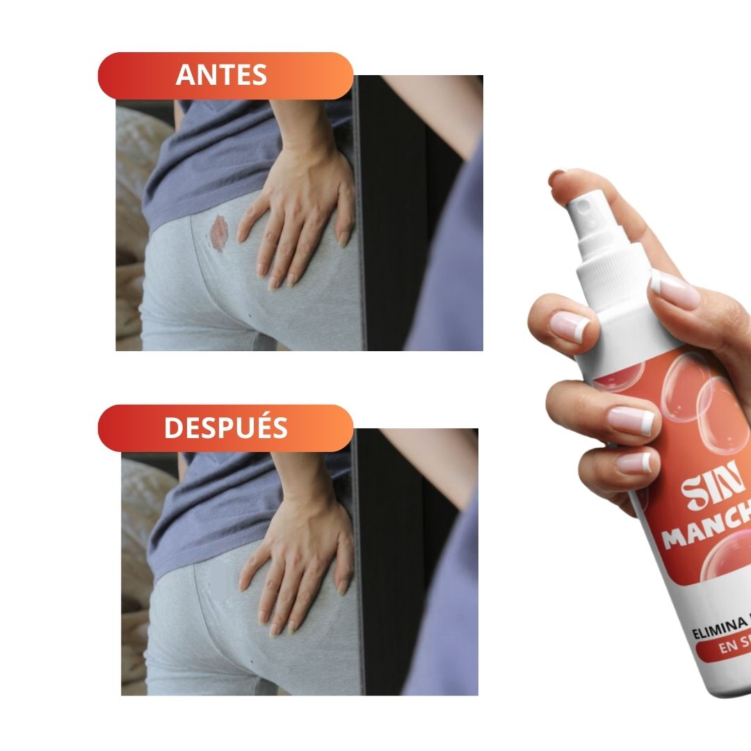 SIN MANCHAS INMEDIATO + ENVÍO GRATIS
